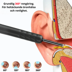 EarSafer - Säker & smart öronrengöring